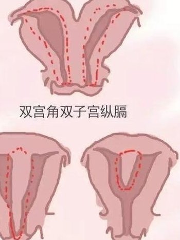 乙肝五项全阴性可以试管以及避免遗传吗？