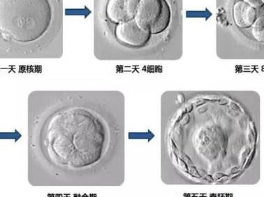 女性有染色体罗氏易位在陕西省做试管养囊成功率高吗？试管移植后需要保胎吗！